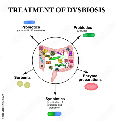 Treatment of dysbacteriosis in the intestines. Colon. Bacteria pathogenic flora. Infographics. Vector illustration on isolated background.