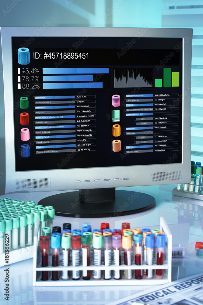 Laboratory analysis table with screen computer and trays with blood ...