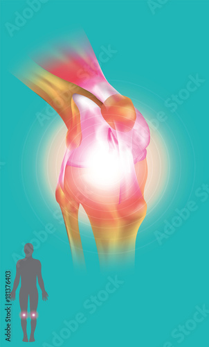 Knee Joint symptom. Illustration anatomy body.
