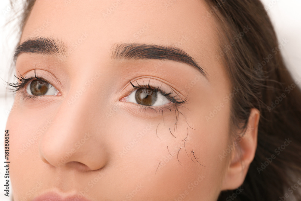 Fototapeta premium Young woman with eyelash loss problem