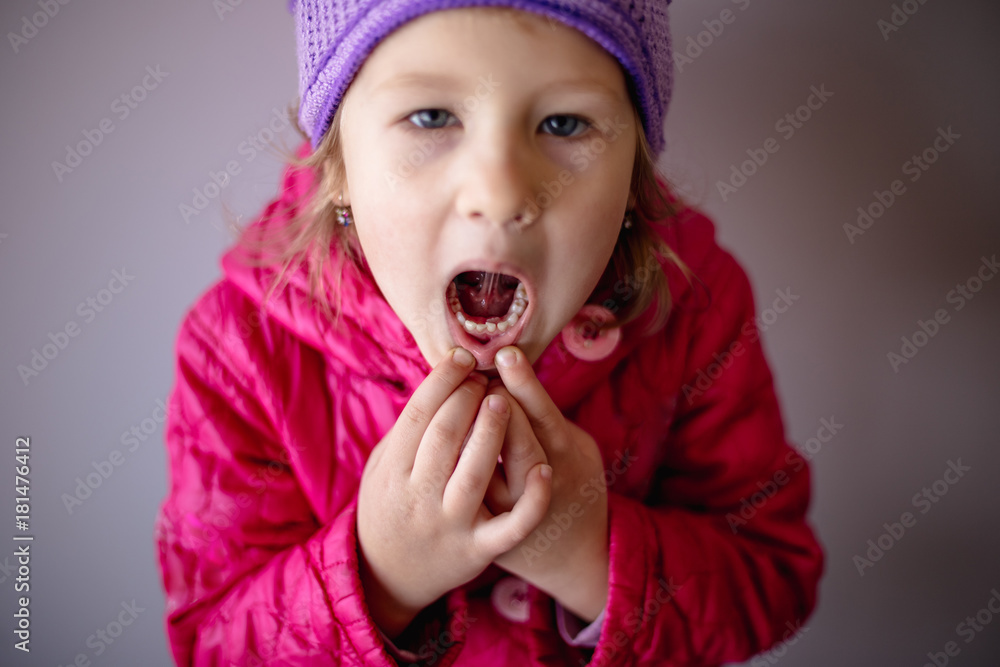 Adult permanent teeth coming in behind baby teeth: shark teeth. Adult permanent teeth coming in behind baby teeth: shark teeth.
