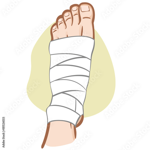 Illustration of firs aid person caucasian, bandaged foot, top view. Ideal for catalogs, information and medicine guides
