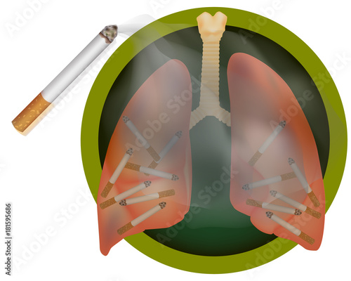 Harm of smoking. Smokers lung. 