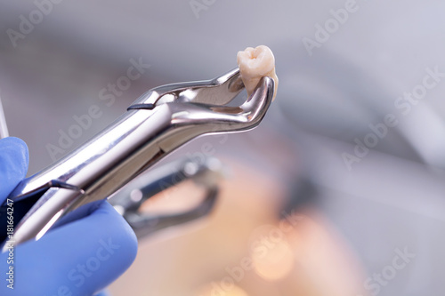 Fototapeta Naklejka Na Ścianę i Meble -  Dental equipment,tooth extraction