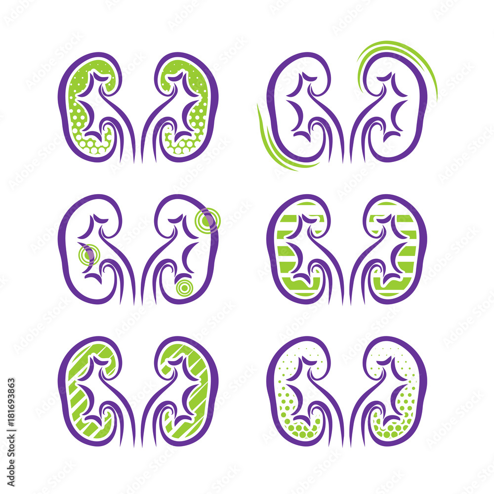 Obraz premium All About Kidneys