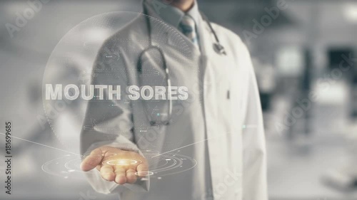 Doctor holding in hand Mouth Sores photo
