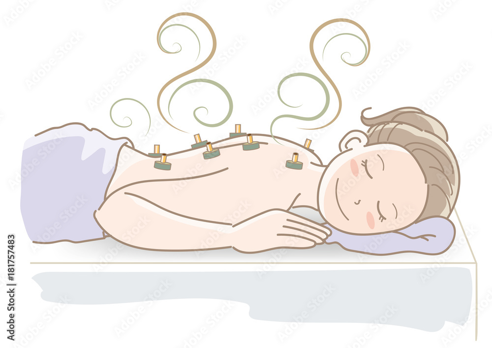 お灸イメージ 女性 Stock ベクター Adobe Stock