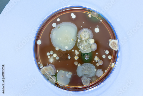 A petri dish with colonies of microorganisms for bacteriological analysis in a microbiological laboratory