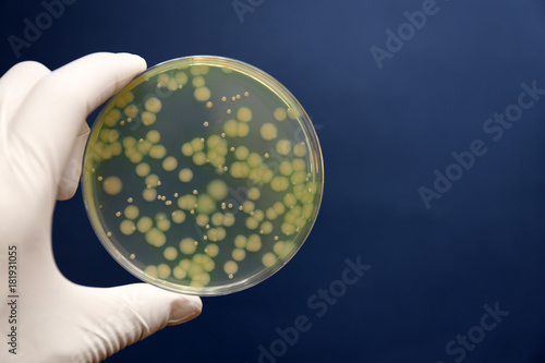 細菌の鑑別　緑膿菌　Pseudomonas aeruginosa photo
