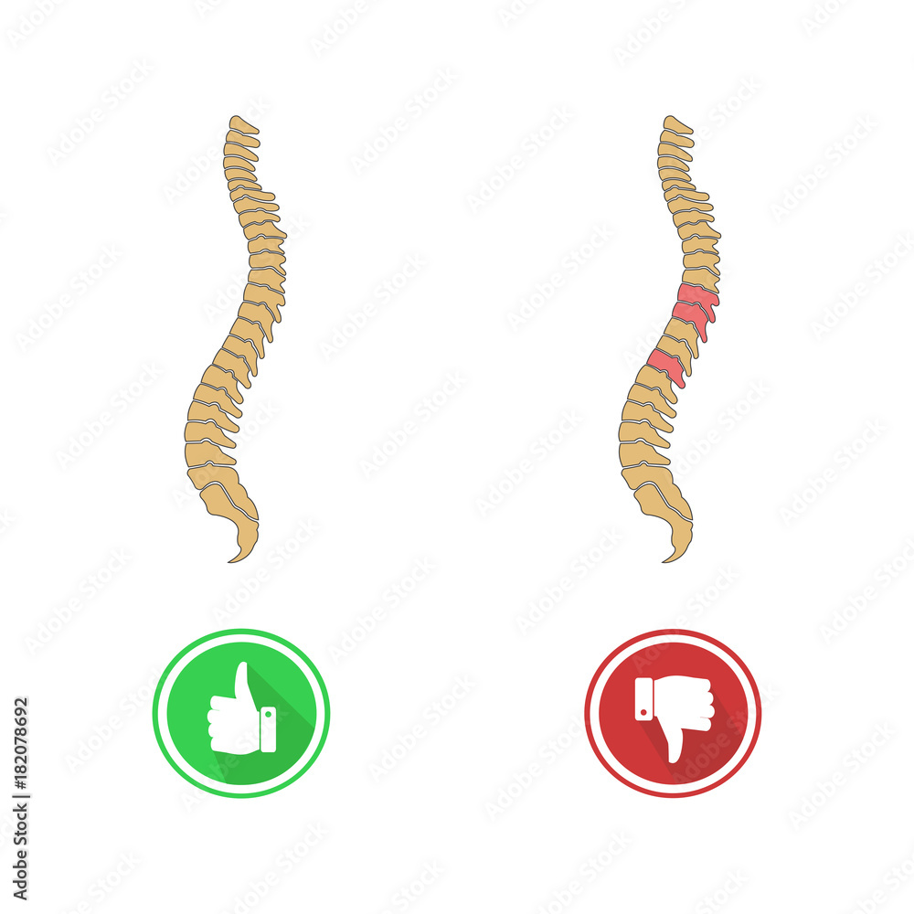 Obraz premium Human Spine, mesh