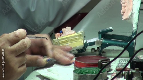 Close-up of the hands of a dental technician preparing the mold of a denture in a workshop. Dental prosthesis laboratory. photo