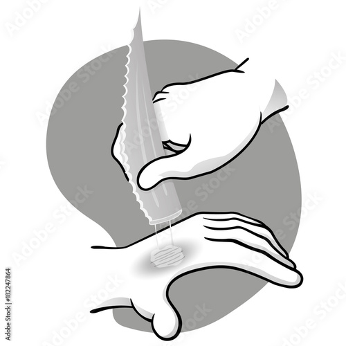 Illustration first aid hands with burn and injury, passing aloe vera, black and white. Ideal for medical, informative and institutional catalogs