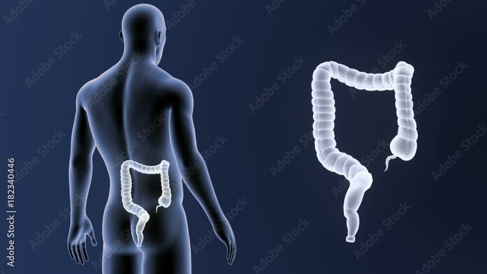 Large Intestine zoom with Body Large Intestine zoom with Body