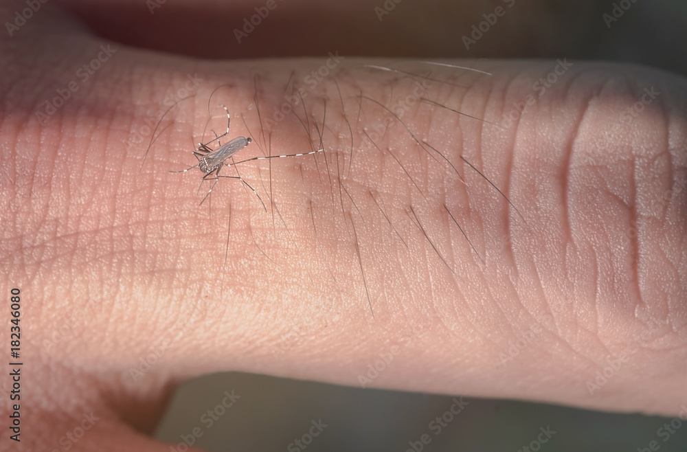 Obraz premium Close-up Mosquito bites that eat blood o the fingers of men cause disease spread.