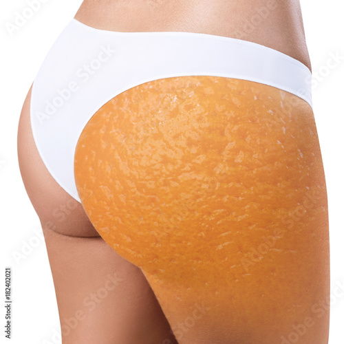 Obraz na płótnie Female buttocks with orange peel texture.