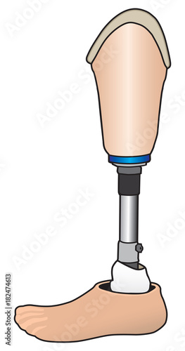 Manufactured prosthetic leg for left below knee amputee