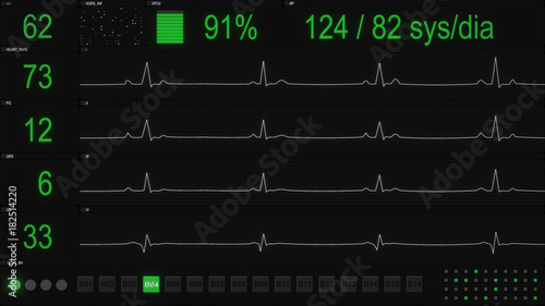 Obraz na płótnie ECG testing software User Interface
