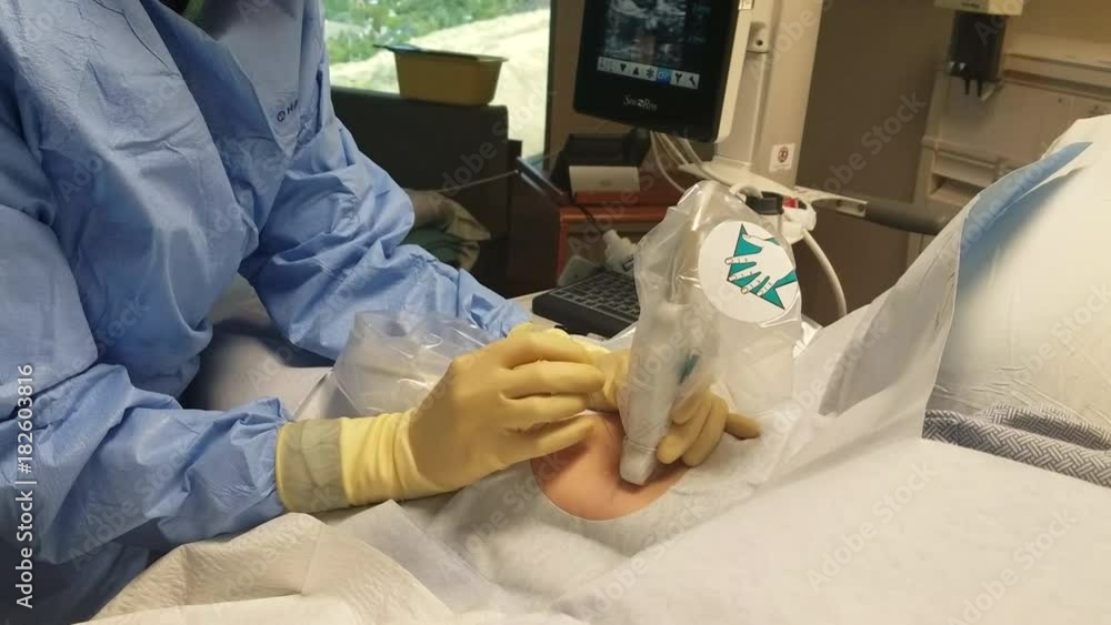Medical surgery insert infusion line in vein hospital. Treated by chemo ...