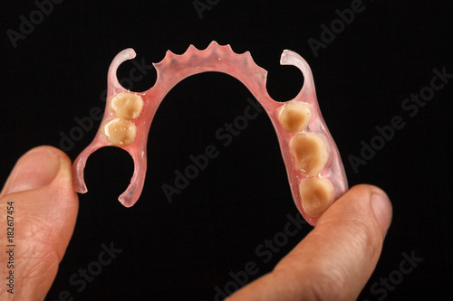 Dental prosthesis in the hand of the dentist.