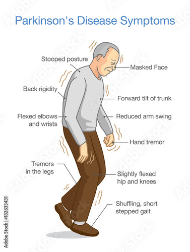 Parkinson's Disease Symptoms. Illustration about health problem of elderly people.
 photo