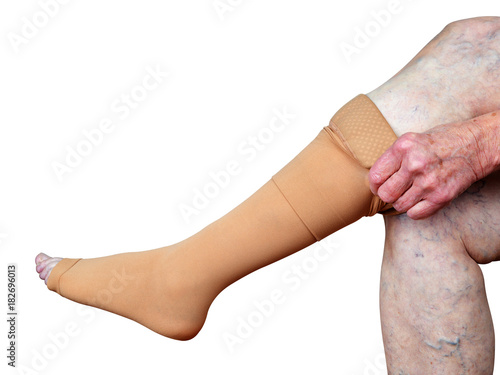 Принти на полотні Thrombosis stockings on a leg of old woman isolated on white background
