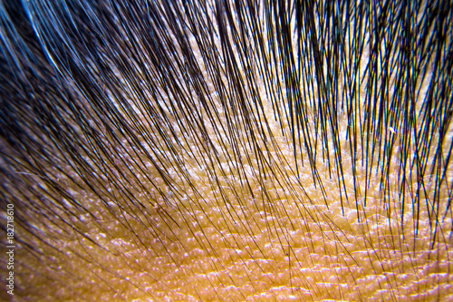 The roots of the hair, black, young and old.