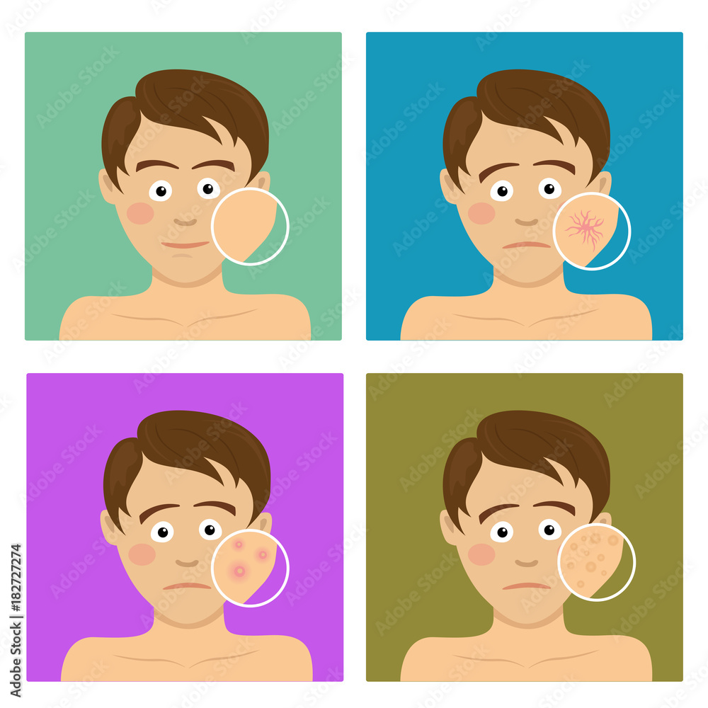 Avatar set for skincare infographic. Teenager boy with facial skin problems Avatar set for skincare infographic. Teenager boy with facial skin problems