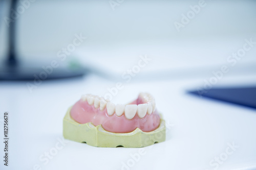 Dental prosthesis on white table