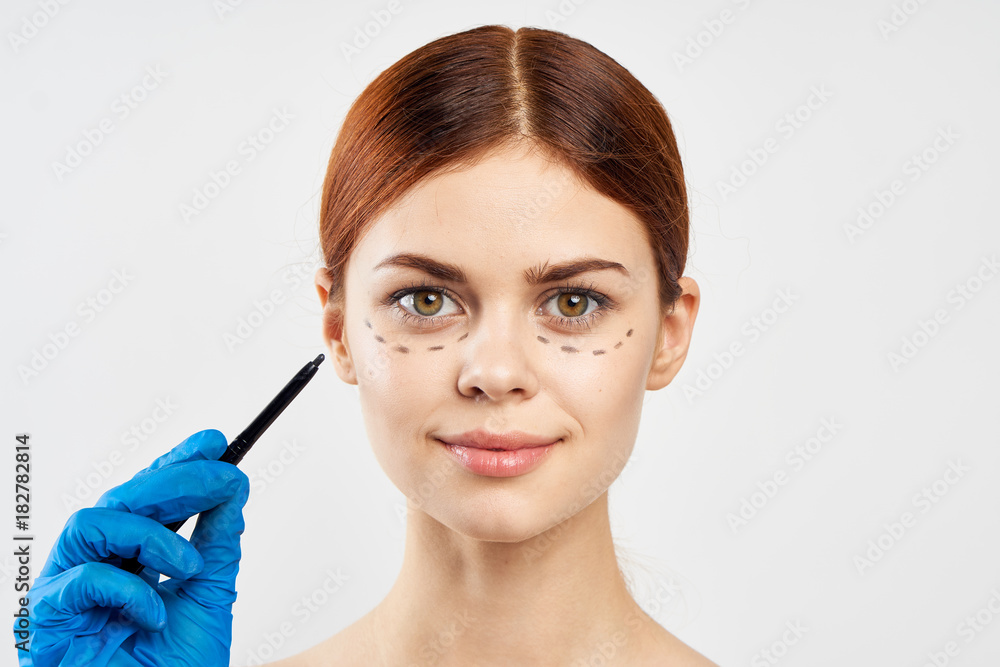 A woman in latex gloves made a markup around her face and is ready for surgery A woman in latex gloves made a markup around her face and is ready for surgery