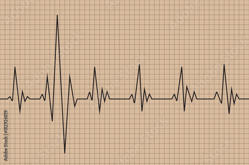 Abnormal cardiogram with grid on brown background