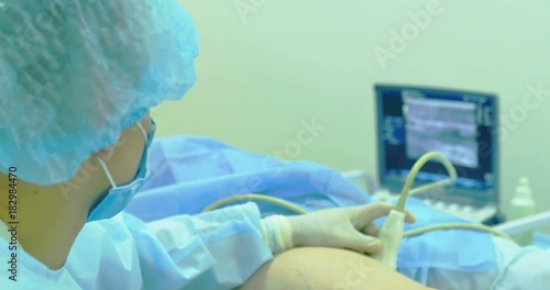 A doctor uses a modern sonogram to view vein in sclerotherapy procedure. An innovative method of varicose veins surgery, close-up