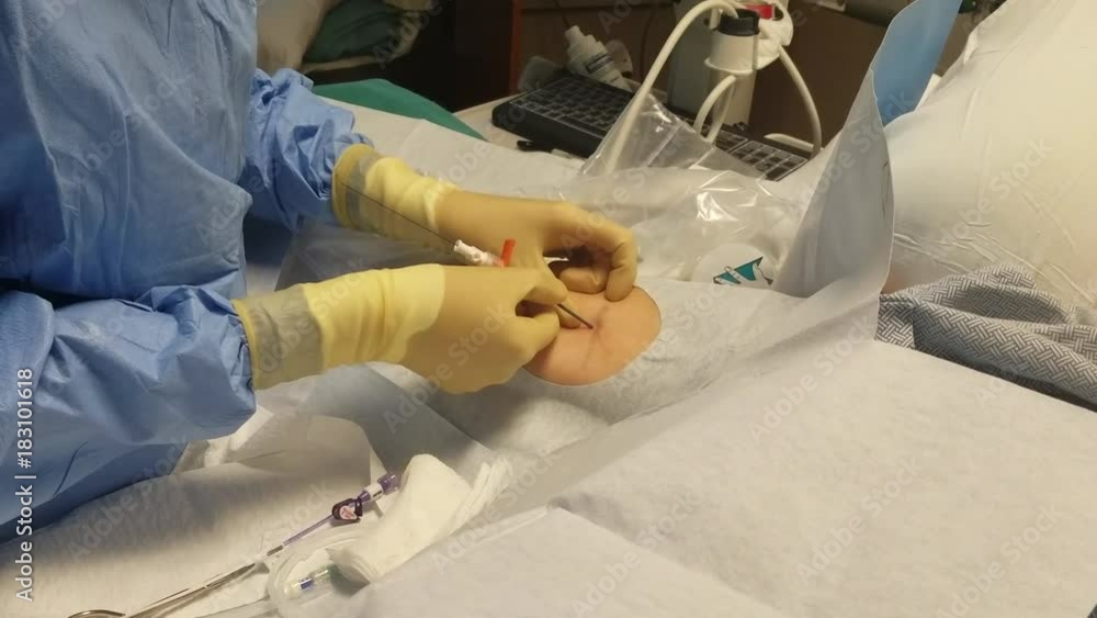Picl Injection Surgery hospital cancer infusion insert procedure. Insert surgically ...