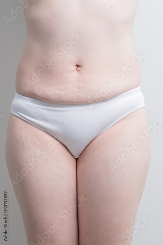 Fat overweight woman