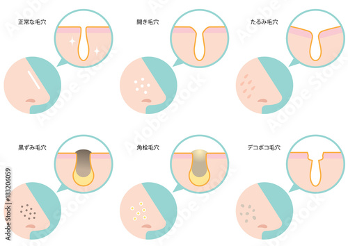 スキンケア　毛穴
