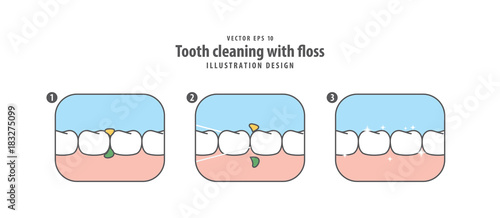 Step of tooth cleaning with floss illustration vector on white background. Dental concept.