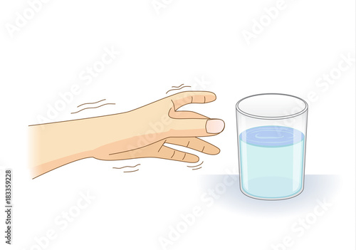 A Hand have tremor symptom reaching out for a glass of water. Illustration about loss of control of balance and body and health problem.