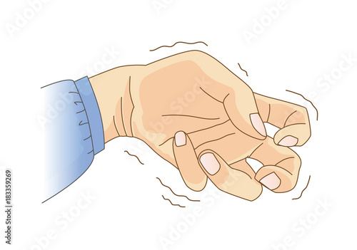 Finger and wrist bend and tremor. Illustration about symptom and sign of Parkinson 's disease and epilepsy.