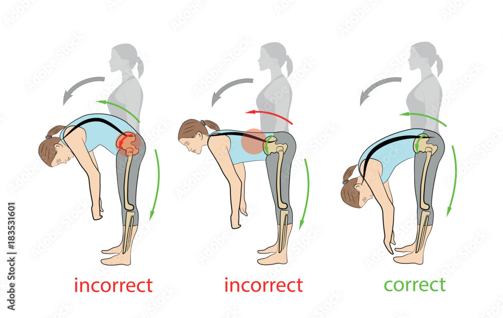 correct and incorrect tilt forward. medical backache problems. vector