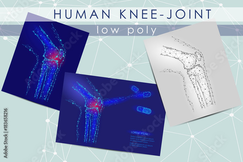 Human knee-joint low poly medicine science illustration set. Knee anatomical pain cure concept. Help keep health drug mechanism action on joint vector polygonal geometric point line