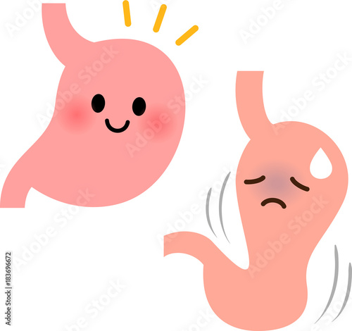 健康な胃と胃下垂になった胃