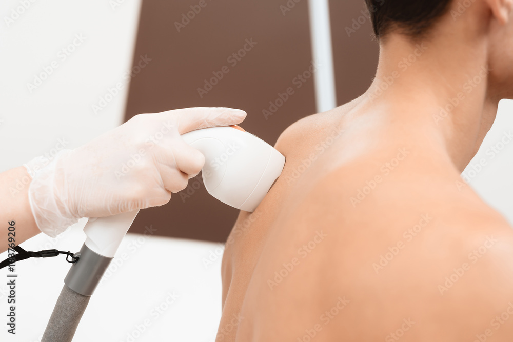 The man came to procedure of laser hair removal. The doctor treats his  shoulders, neck and back with a special apparatus Stock Photo | Adobe Stock
