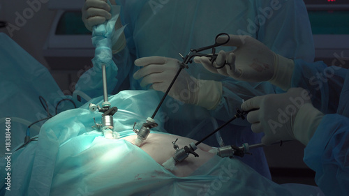 Fotografie Operation using laparoscopic equipment. Surgeons team. Hospital.