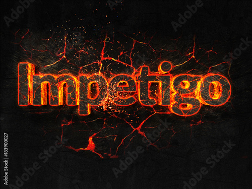 Impetigo Fire text flame burning hot lava explosion background.