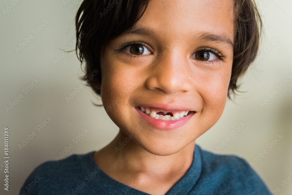 happy child grins with lost teeth happy child grins with lost teeth