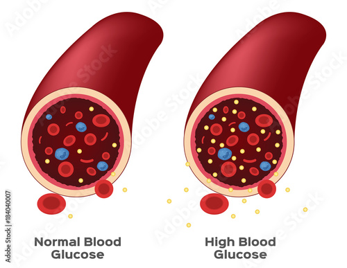 glucose in blood vector