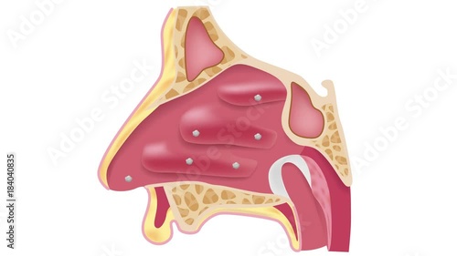 inflammation sinus . nasal anatomy graphic animation photo