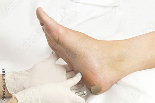 Female foot in the process of pedicure procedure in a beauty salon close-up.