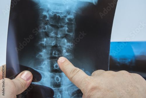 Foto Doctor pointing out on diagnose on x-ray