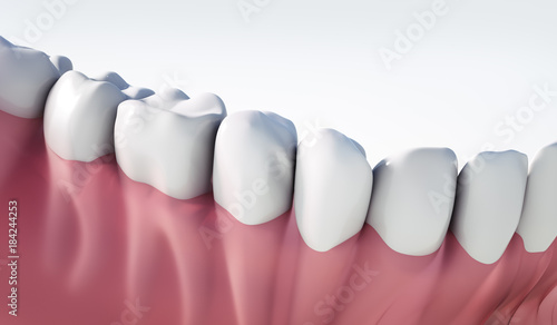 Zahnreihe mit Zahnfleisch