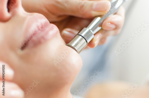 Diamond microdermabrasion skin face treatment photo